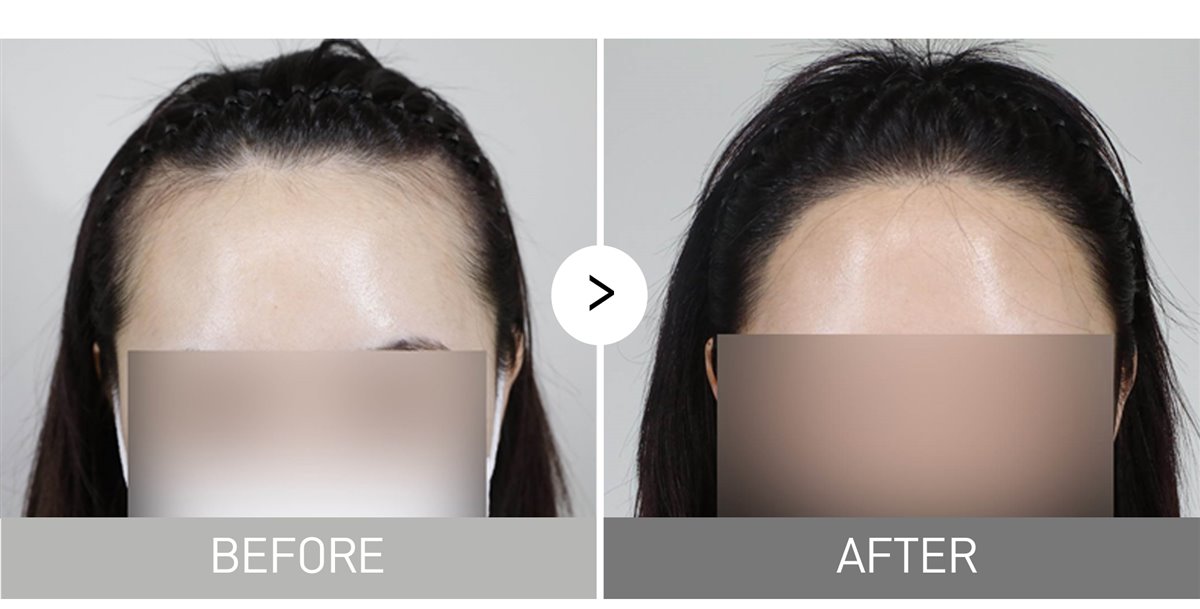 Nine months on, here is my update