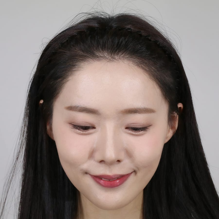 바카스 수술 후