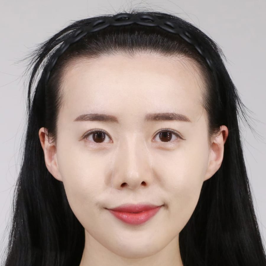바카스 수술 전