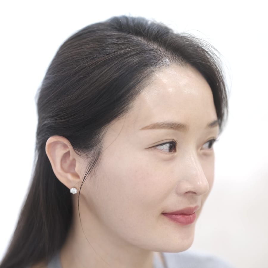 정은 수술 후