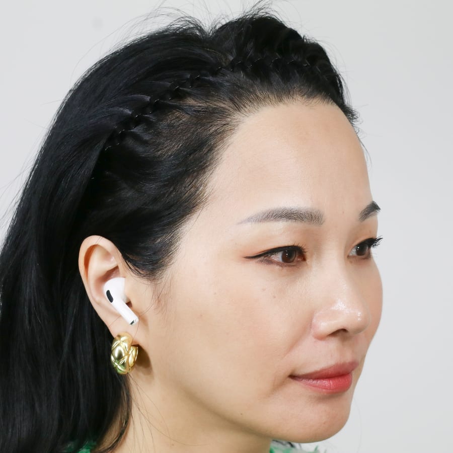 선아 수술 후