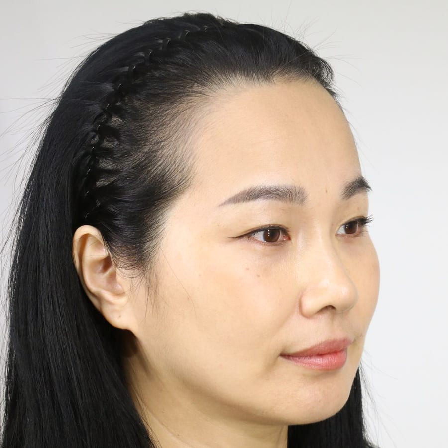 선아 수술 전