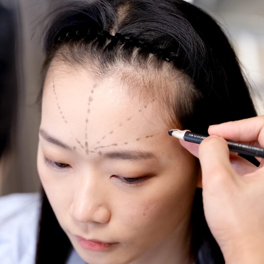 연아 수술 전