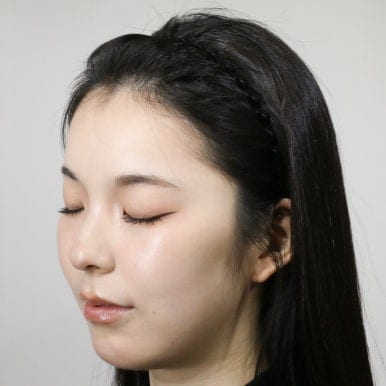 유나 수술 후