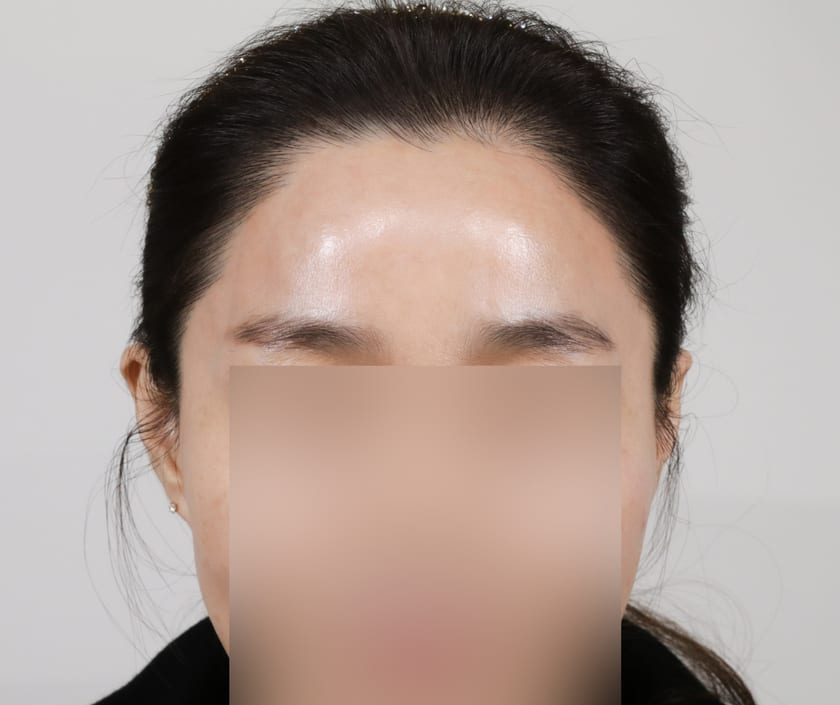 AFTER 여성 온 가족 케이스 · 어머님