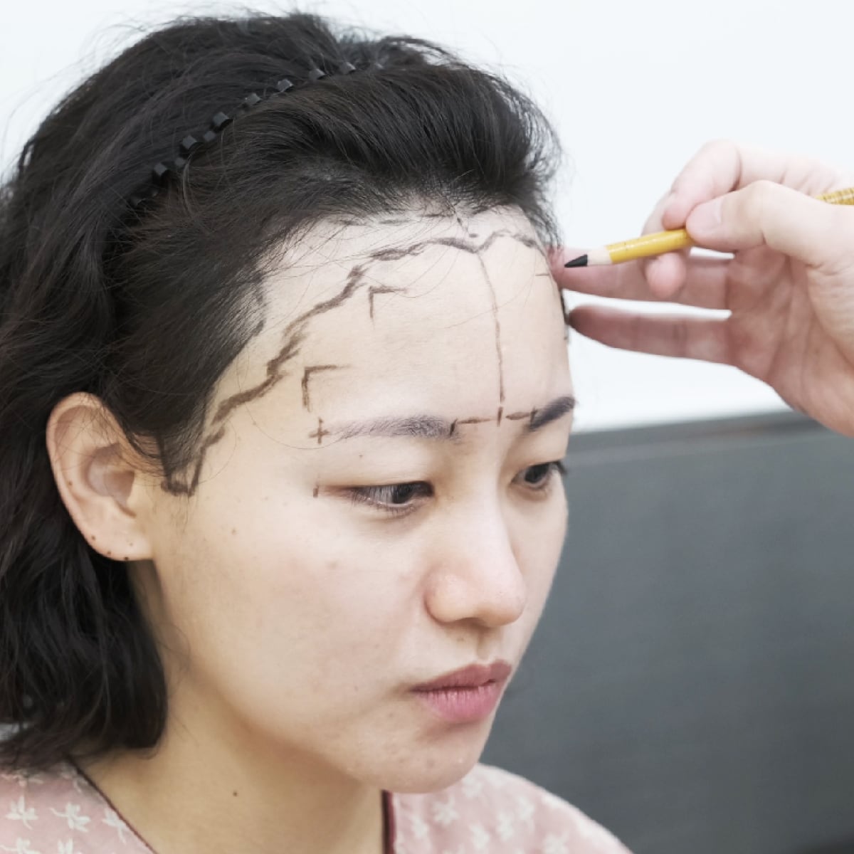 원장이 연필로 이마 위에 헤어라인 디자인 선을 그리는 모습