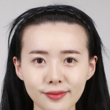 바카스 수술 전