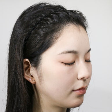 AFTER Yuna FUE box cut · ด้านข้าง 1,300 กราฟต์ · ปรับแนวผม