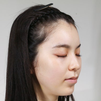BEFORE Yuna FUE box cut · ด้านข้าง